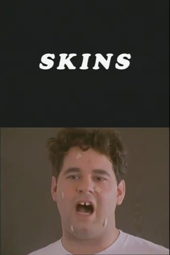 Skins