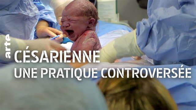 The C-Section Controversy